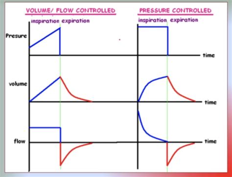 Fichas de aprendizaje Ventilator modes | Quizlet