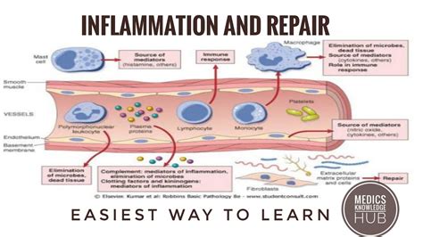 Inflammation And Repair Made Easy By Medics Complete Lecture Learn In