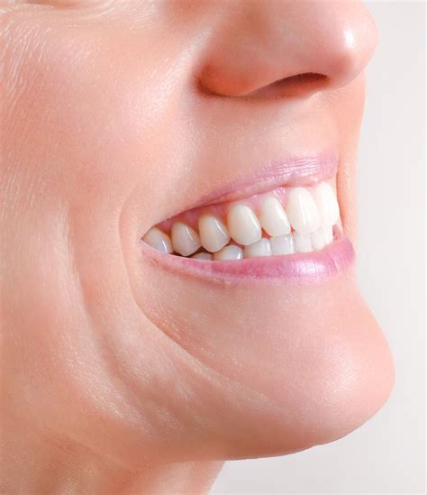 Cosmetic Dentures Chalfont St Peter Gerrards Cross Face Teeth Smile