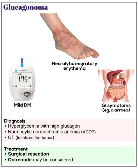 Glucagonoma - Medicine Keys for MRCPs