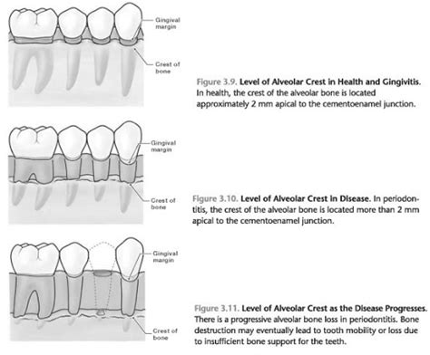 Supporting Alveolar Bone