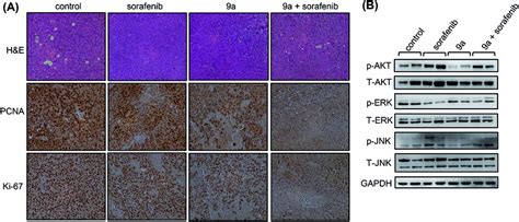 Anti Proliferative Effect Of Compound 9a And A Low Dose Of Sorafenib In