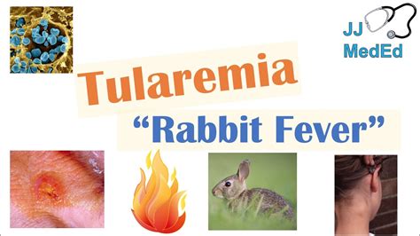 Tularemia Rabbit Fever Causes Pathogenesis Forms Symptoms