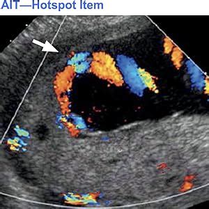 Ob Gyn Sonography An Interactive Mock Exam For The Ardms Specialty