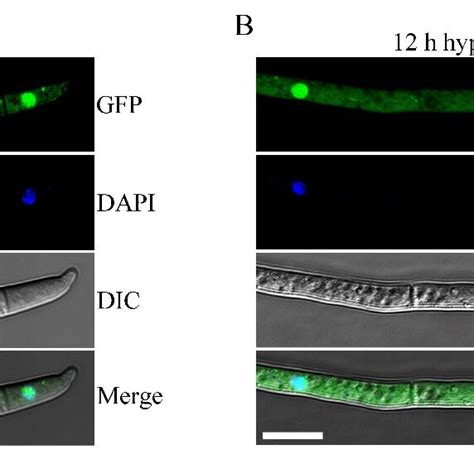 Subcellular Localization Of Sgh1 Gfp Fusion Protein A Fresh Conidia Download Scientific