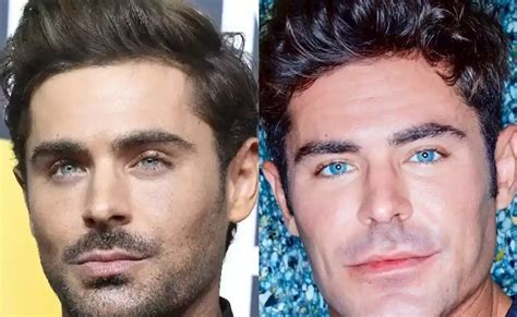 Zac Efron Botox Cirug A Pl Stica El Actor Revela El Motivo Del