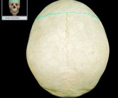 Anterior and Superior Skull Flashcards | Quizlet