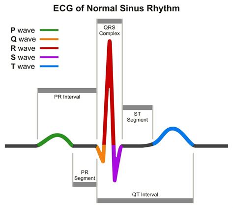 PR Interval: A Comprehensive Guide - Nursing Schools Near Me