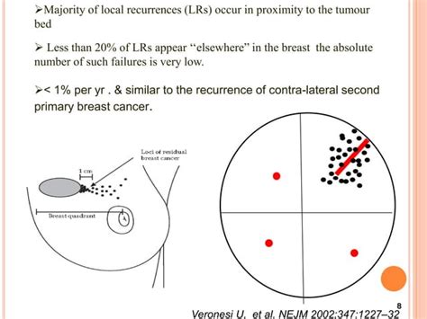 Accelerated Partial Breast Irradiation Ppt