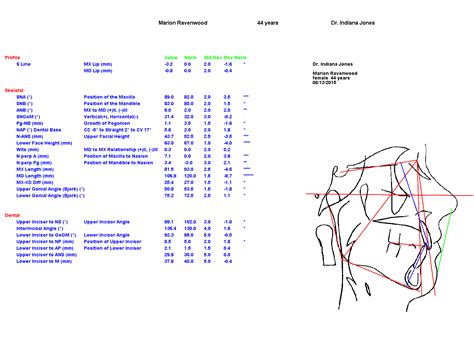 Cephalometrics Five Star Orthodontic