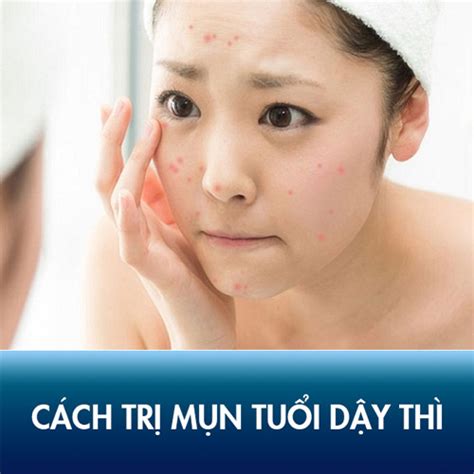 Nguyên Nhân Bị Mụn ở Má KhÔng Ai NgỜ TỚi Và Cách Trị Mụn ở Má Tận Gốc