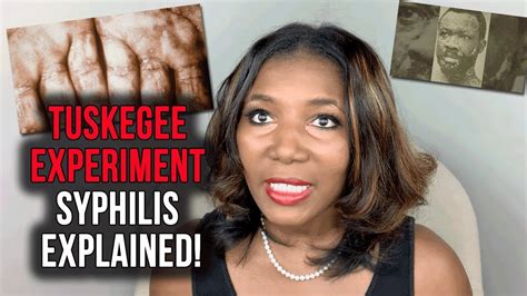 Tuskegee Syphilis Experiment - Syphilis Explained