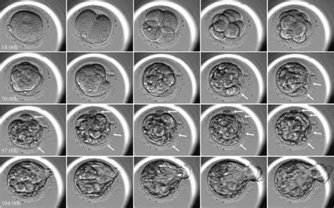 Embryoscope Can Further Develop IVF