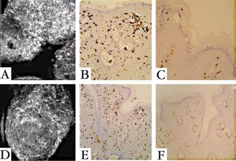 SciELO Brasil Genital Warts Comparing Clinical Findings To