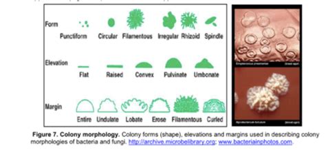 Clip mariposa extraño Brillar colony morphology Eliminar Adoración Gaseoso