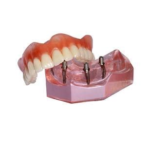 Dentures Owasso Replace Missing Teeth Infinite Smiles Dentistry