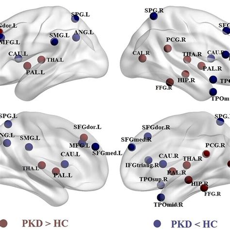 Regions Of Significant Differences In Nodal Centralities Of Brain Gray