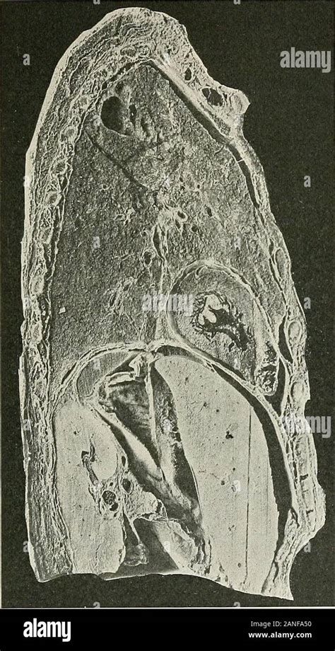 Diseases of the chest and the principles of physical diagnosis ...