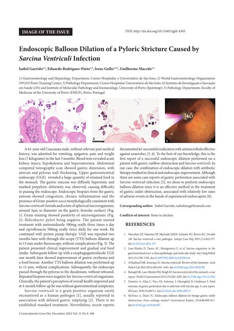 Pdf Endoscopic Balloon Dilation Of A Pyloric Stricture Caused By