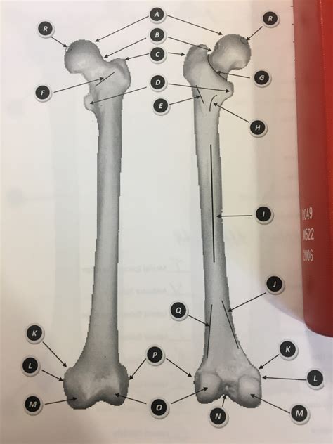 Femur Boney Landmarks Diagram Quizlet