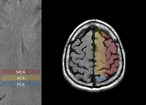 Anatomy Of Cerebral Arteries | STROKE MANUAL