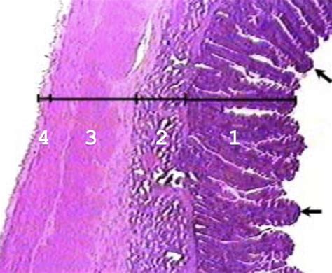 Duodenum And Ilium Histology Flashcards Quizlet