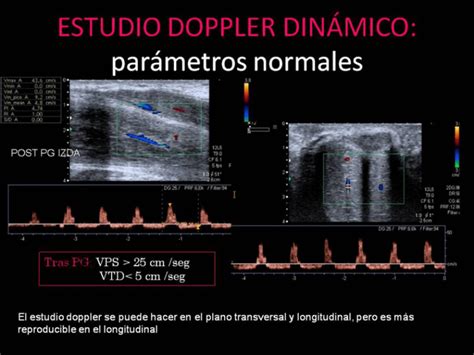 Ecografía Doppler de Pene Urologia