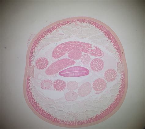 Ascaris Lumbricoides Male Cross Section Parasitology Porn Sex Picture