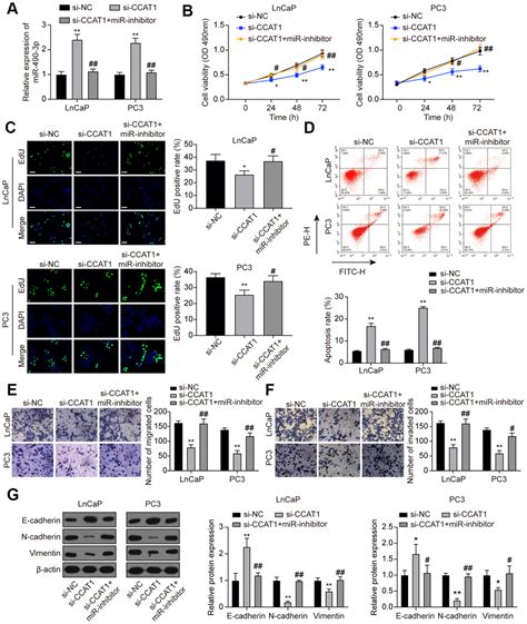 Lncrna Ccat Promotes Prostate Cancer Cells Proliferation Migration