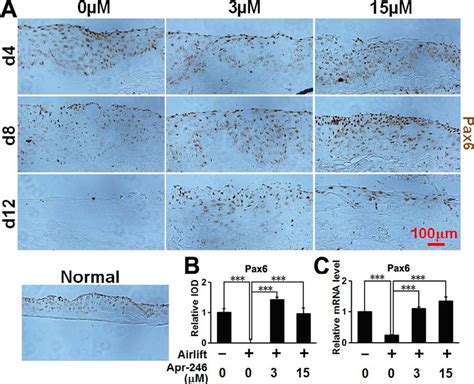 Pax Expression In Conjunctival Tissue A Normal Conjunctival