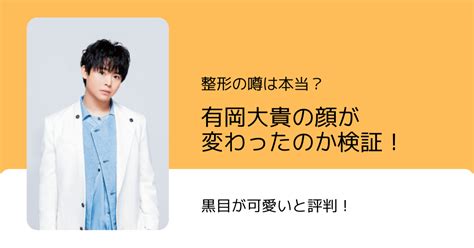 有岡大貴の顔が変わったのか検証！整形の噂は本当？黒目が可愛いと評判！ Exceptional Wakuwaku