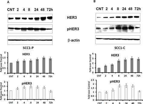 Her Targeting Sensitizes Hnscc To Cetuximab By Reducing Her Activity