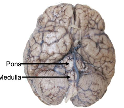 Anatomy Of The Medulla And The Pons Lab 7 Flashcards Quizlet