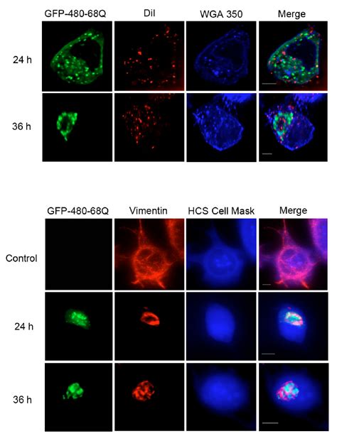 Fig S Gfp Q Aggregates Are Not Surrounded My Membrane And Are