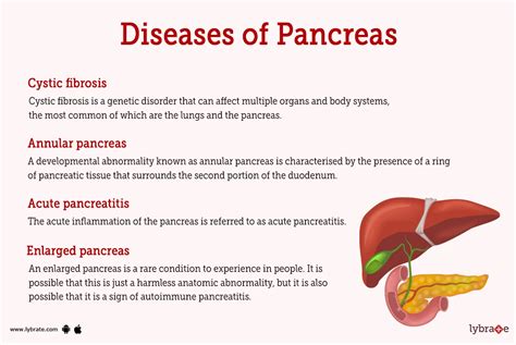 Pancreas Human Anatomy Picture Function Diseases Tests And