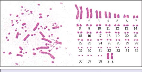 Figure From Analysis Of Chromosome Karyotype And Banding Patterns Of