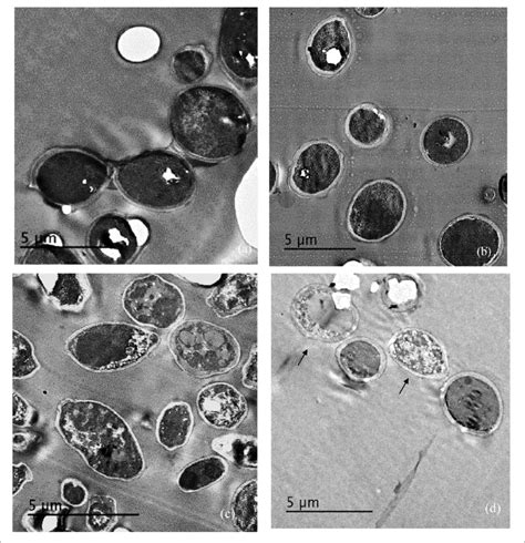 Transmission Electron Microscope TEM Images Of Treated And