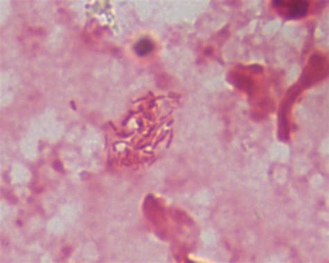 Actinobacillus Pleuropneumoniae On Cytology From Porcine L Flickr