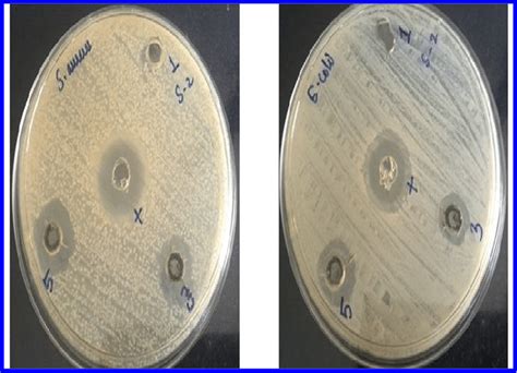 Zone Of Inhibition Of Mg Doped Zno Nanoparticles Against S Aureus And