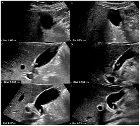 Tomography Free Full Text Comparison Of The Size Measurement Of