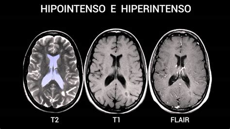 Imágenes diagnósticas mod 3 Clip 6 YouTube