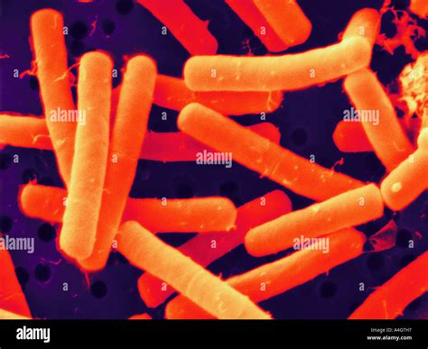 This Is A Colour Enhanced Scanning Electron Micrograph Of The Soil