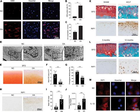 Frontiers Rip Perturbation Induces Chondrocyte Necroptosis And