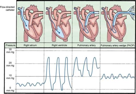 Hemodynamics Flashcards Quizlet