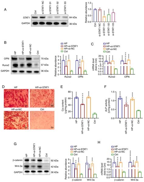 Exosomal STAT1 Derived From High Phosphorusstimulated Vascular