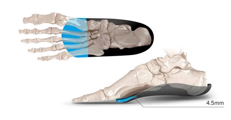 Orthofeet Metatarsal Dome Deals