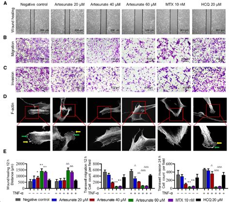 Effects Of Artesunate On Migration And Invasion Of Primary Ra Fls A C