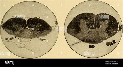 Diseases of the nervous system Stock Photo - Alamy