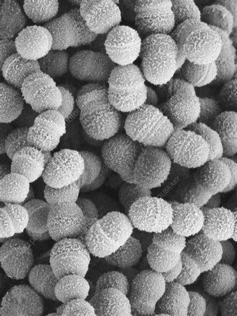 Streptococcus salivarius, SEM - Stock Image - C037/0162 - Science Photo ...