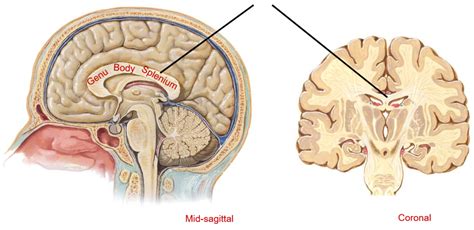 Corpus Callosum Diagram